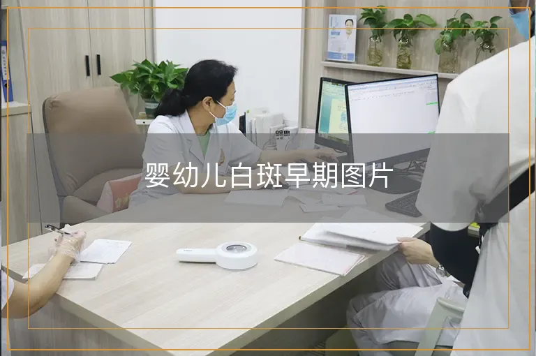 婴幼儿白斑早期图片