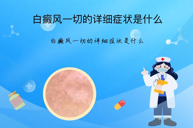 白癜风一切的详细症状是什么